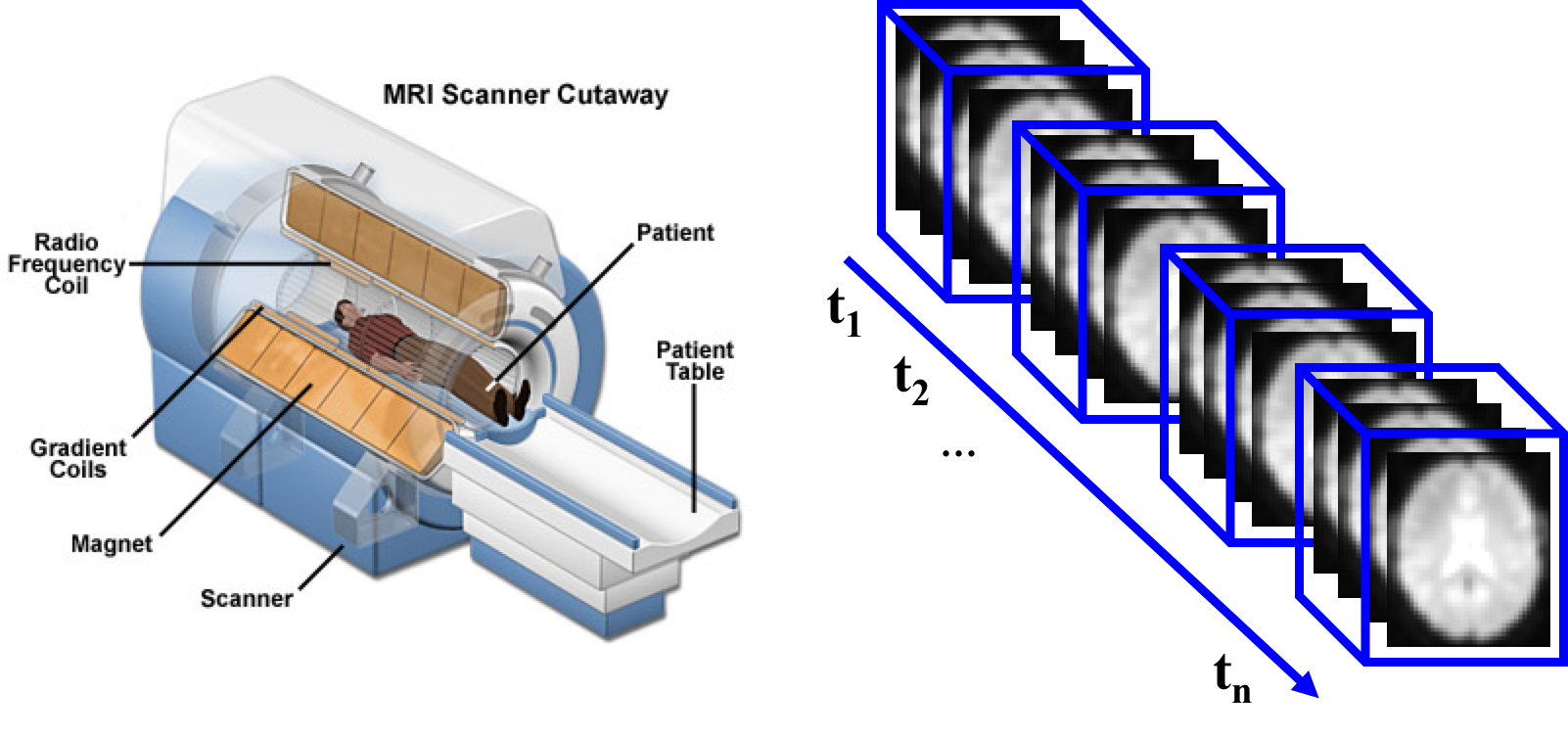 Figure 1: MRI Scanner and rs-fMRI time series acquisition.