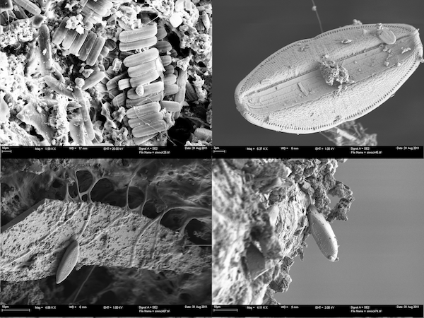 Figure 2: Scanning Electron Micrographs of diatom colonies based on soil samples collected from Yellowstone National Park, courtesy of James Meadow. 