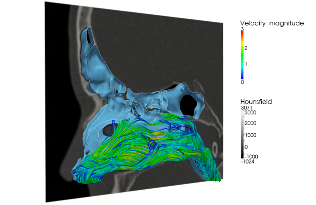 Figure 2: ZFS has been used to to better understand airflow within the human nasal cavity.