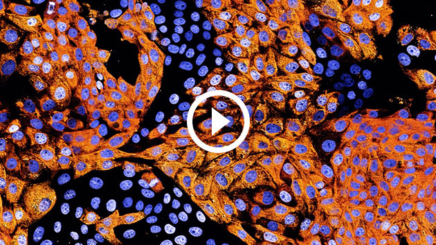 Visualize Microscopy Images of Living Cells in Real Time